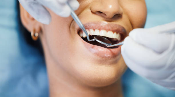Best Emergency Root Canal Treatment in Orland Park, IL
