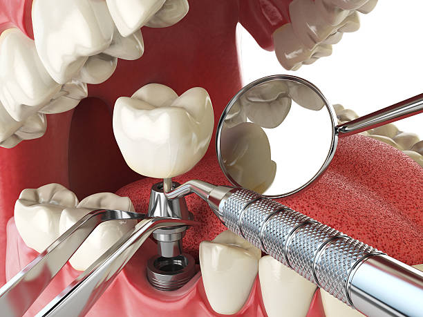 Best Emergency Orthodontic Repairs in Orland Park, IL